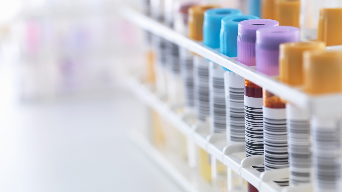 the-pros-and-cons-of-a-rare-diseases-registry